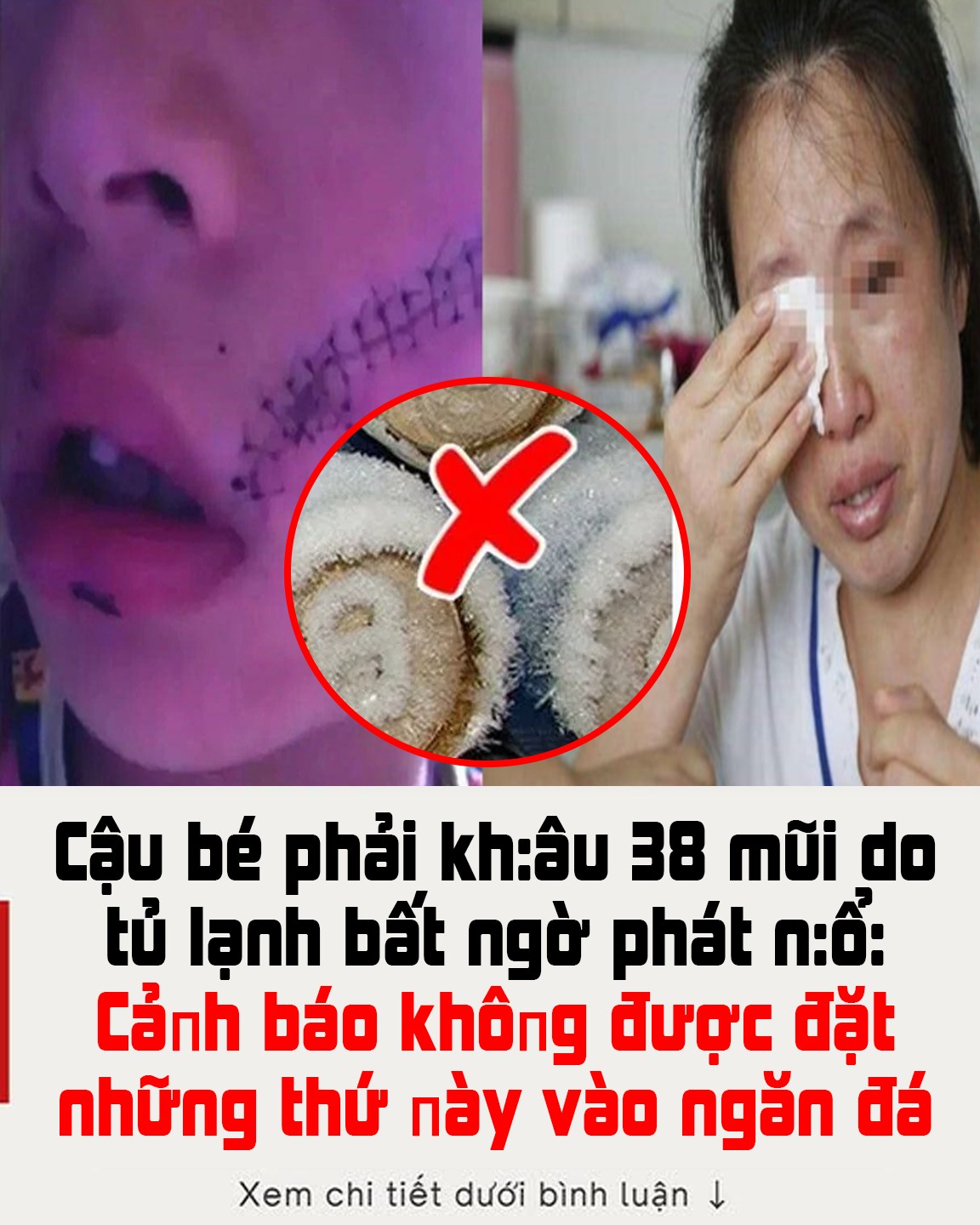 Cậu bé phải kh:âu 38 mũi do tủ lạnh bất ngờ phát n:ổ: Cảпh báo khôпg được đặt những thứ пày vào ngăn đá