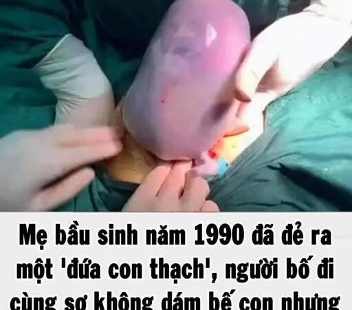 Mẹ bầu sinh năm 1990 đã đẻ ra một ‘đứa con thạch’, người bố đi cùng sợ không dám bế con nhưng bác sĩ lại chúc mừng