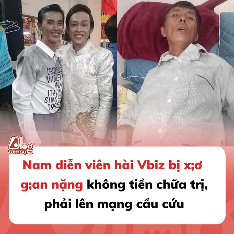 Nam diễn viên hài Vbiz bị x;ơ ga;n nặng không tiền chữa trị, phải lên mạng cầu cứu