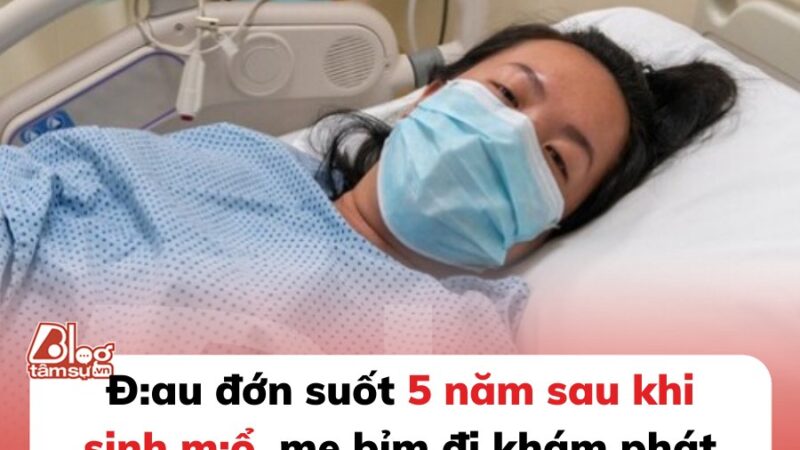 Mẹ bỉm đau đớn suốt 5 năm sau sinh m:ổ, đi khám phát hiện sai lầm động trời của bác sĩ