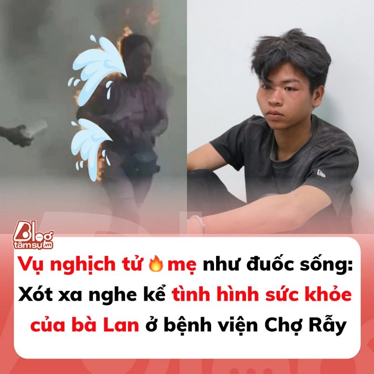 Vụ nghịch tử thiê;u chá;y mẹ như đuốc sống: Xót xa nghe kể tình hình sức khỏe của bà Lan ở bệnh viện Chợ Rẫy