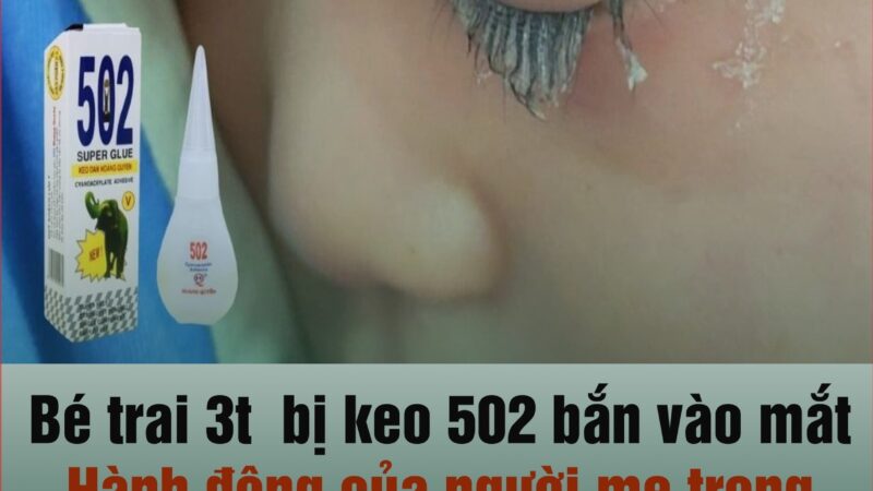 Con trai không may làm đổ keo 502 vào mắt, người bố nhanh trí nhỏ thêm thứ n.ày c.ứu con, kết quả thần kỳ ngoài sức tưởng tượng