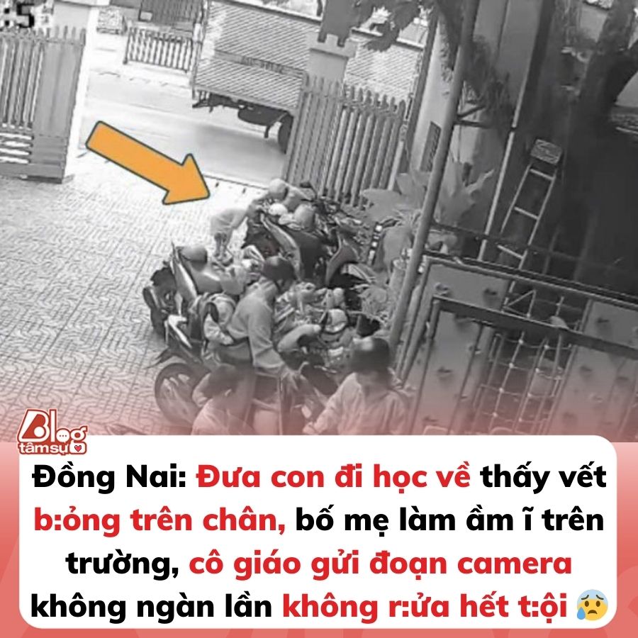 Làm ầm ĩ khi thấy bất thường trên chân con trai, phụ huynh ngỡ ngàng nhận ra sự thật khi check camera an ninh